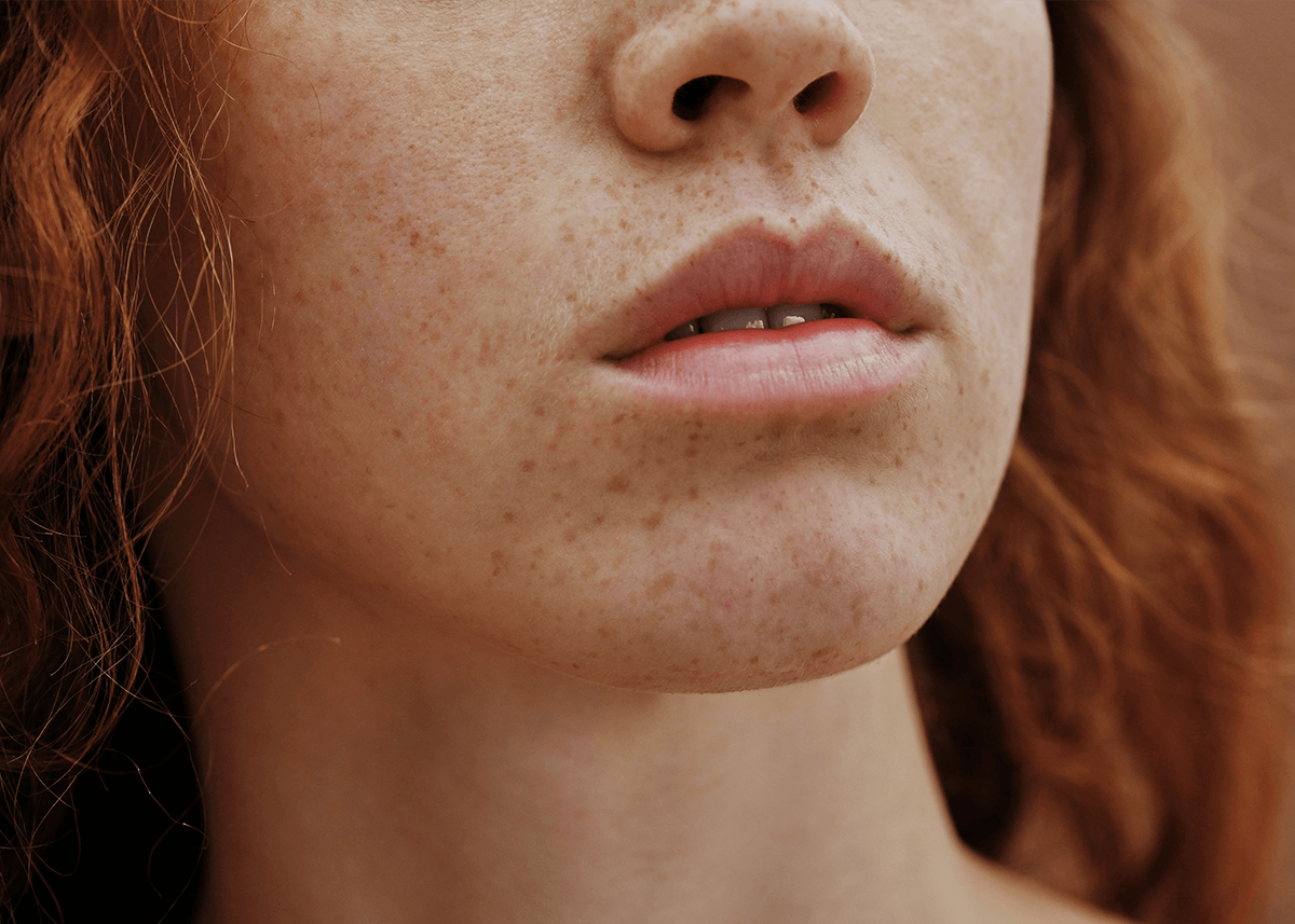Young Girl with Freckles Red Hair Closeup